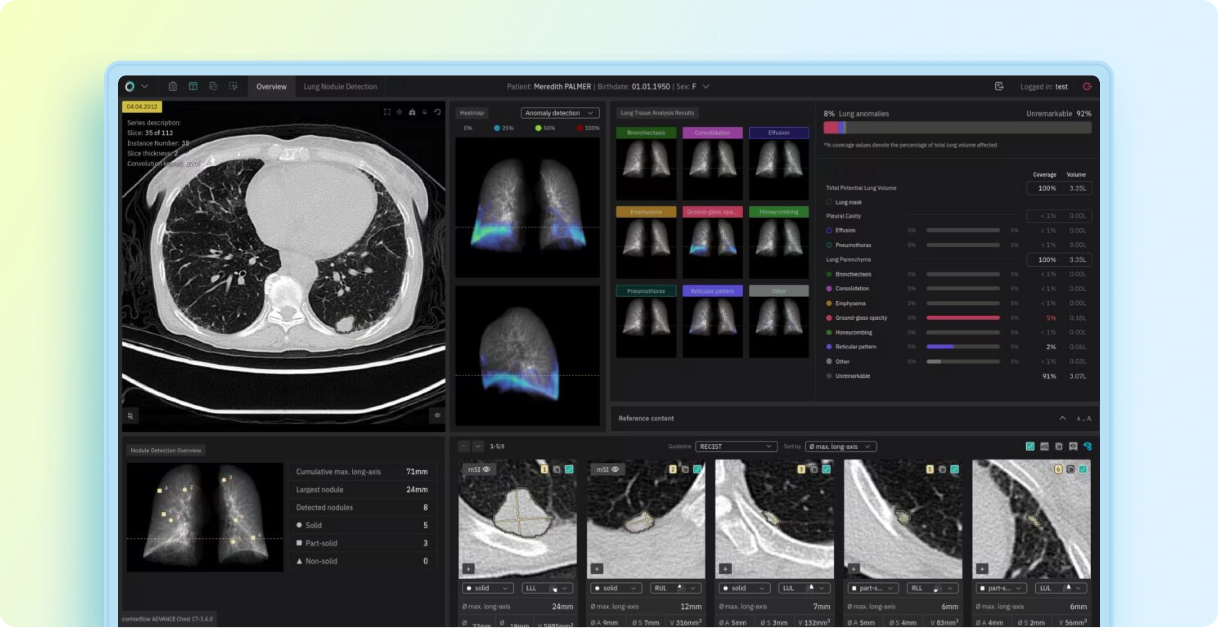 ADVANCE Chest CT